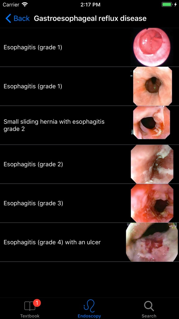 【图】ENDO3® Gastrointestinal Atlas(截图2)
