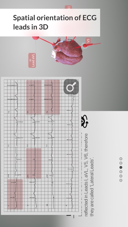 3D ECG Leads screenshot-5
