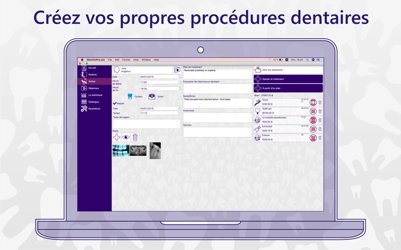 iDentist Pro Dentistry screenshot 4