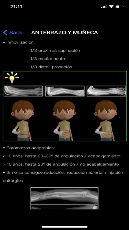 OrtoTrauma screenshot-5