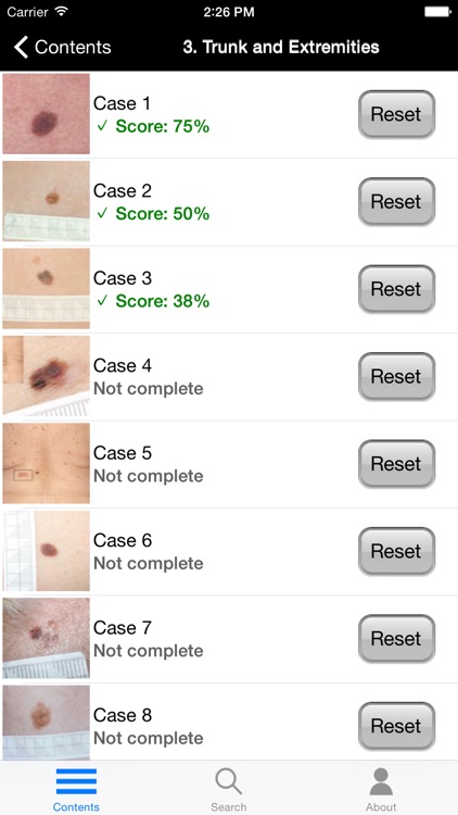 Dermoscopy Self-Assessment screenshot-4