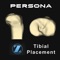 The Persona® TKA Tibial Placement App provides surgeons with an interactive experience that simulates placing an artificial knee implant onto a resected bone