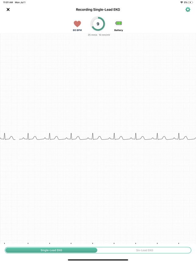 643x0w AliveCor Kardia Mobile - EKG für die Hosentasche im Test Gadgets Smartphones Tablets Technologie Testberichte 