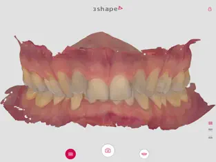 Captura 2 my3Shape para pacientes iphone