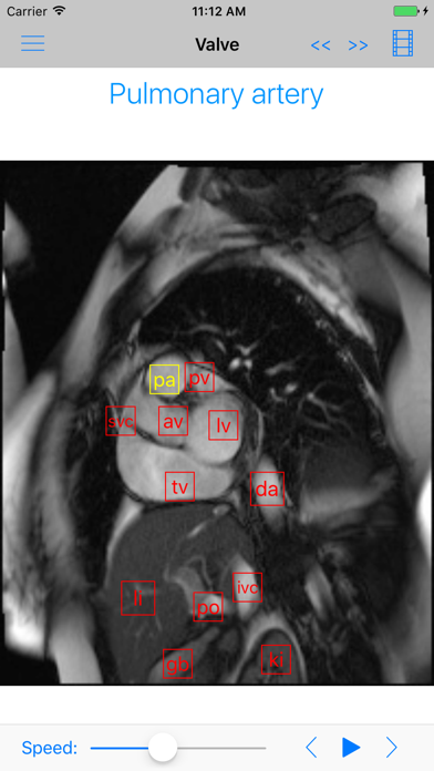 How to cancel & delete iAnatomy-Cardiac from iphone & ipad 3