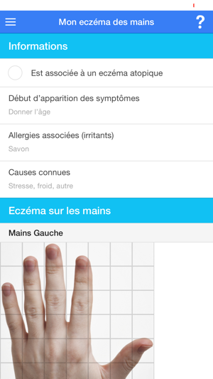 Vivre avec un Eczéma des mains(圖3)-速報App