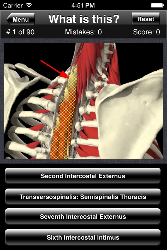 Anatomy Spine Quiz screenshot 2