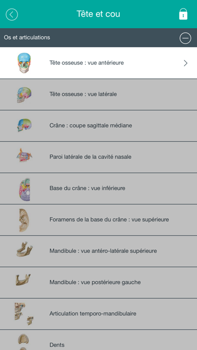 How to cancel & delete Mémofiches Anatomie Netter from iphone & ipad 2