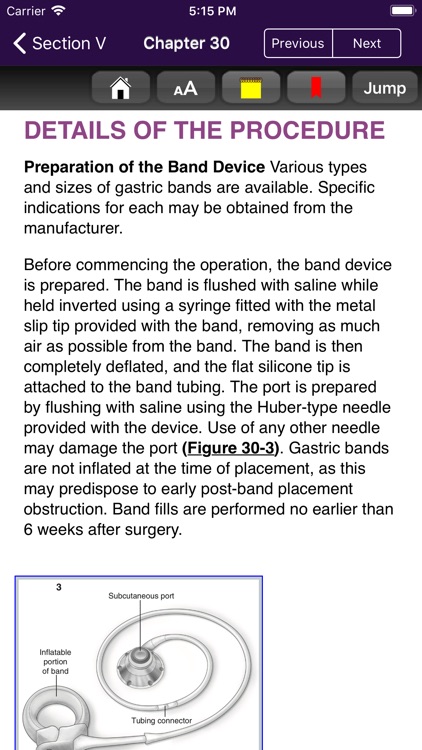 Atlas of Min. Invasive Surgery screenshot-3
