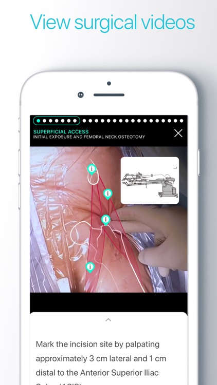 Touch Surgery: surgical videos screenshot-4