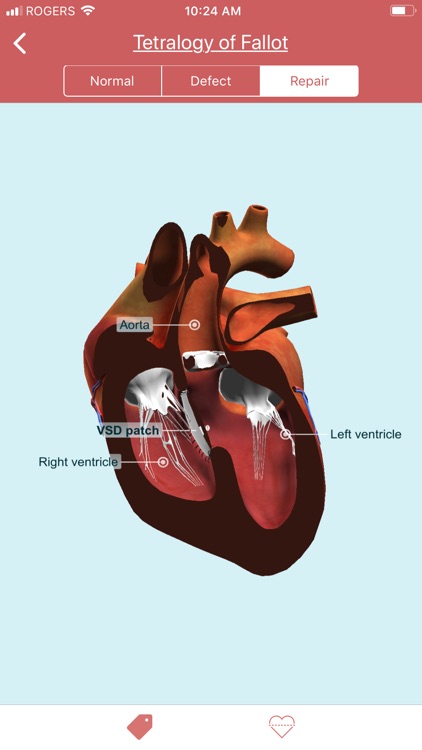 eMurmur Heartpedia screenshot-3