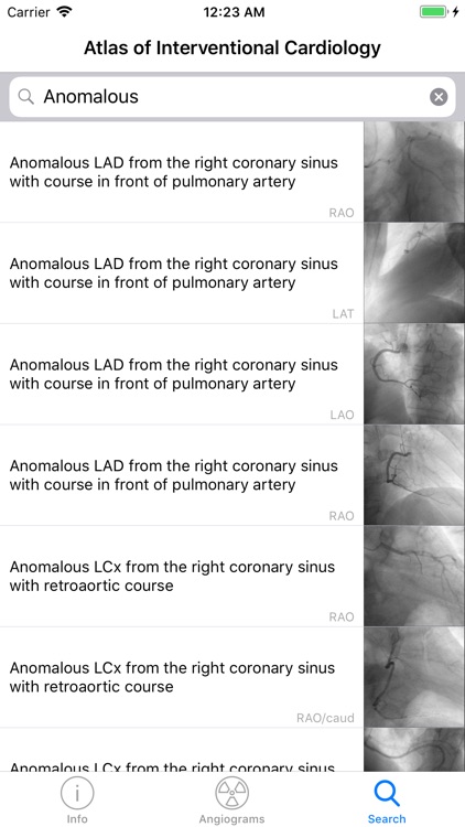 CARDIO3® Interventional Atlas screenshot-4