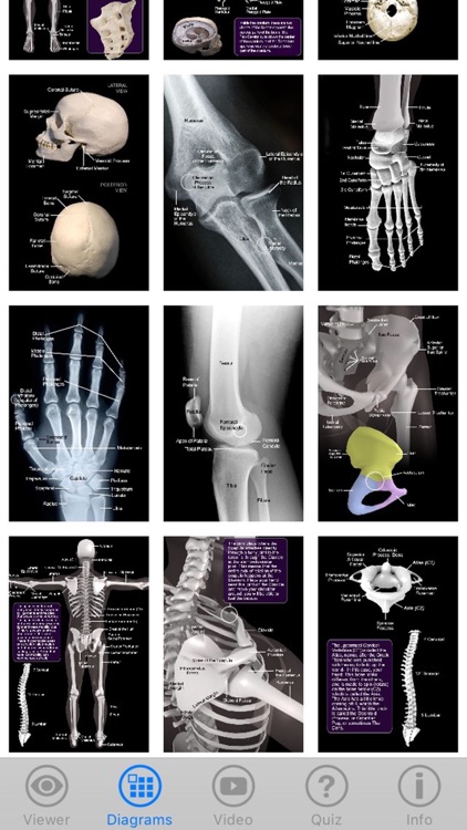 Skeletal Anatomy 3D screenshot-3