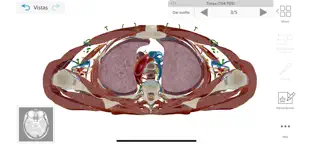 Captura de Pantalla 5 Atlas de anatomía humana 2021 iphone