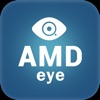 AMD_eye