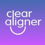Clear Aligner