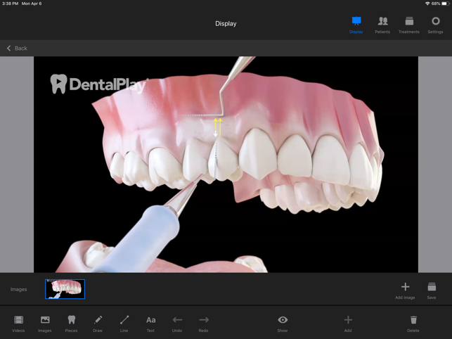 Dentool(圖3)-速報App