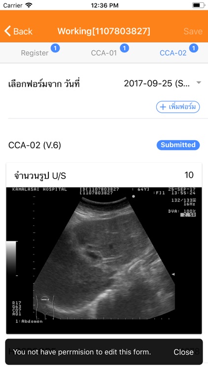 CASCAP Mobile U/S screenshot-4