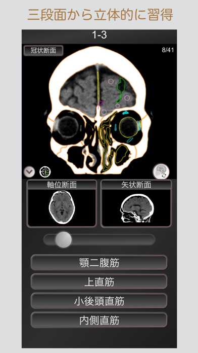 Ct Passquiz 頭部 脳 Ct断面図解剖mri Iphoneアプリ Applion