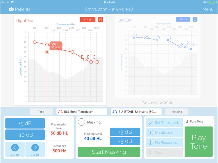 SHOEBOX Audiometry Pro