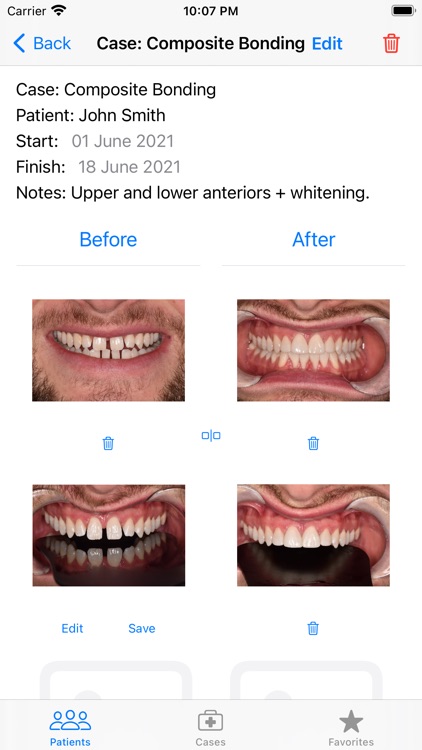 Casebook Before & After Photos