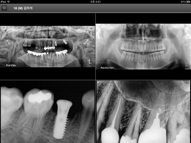 CDX View I