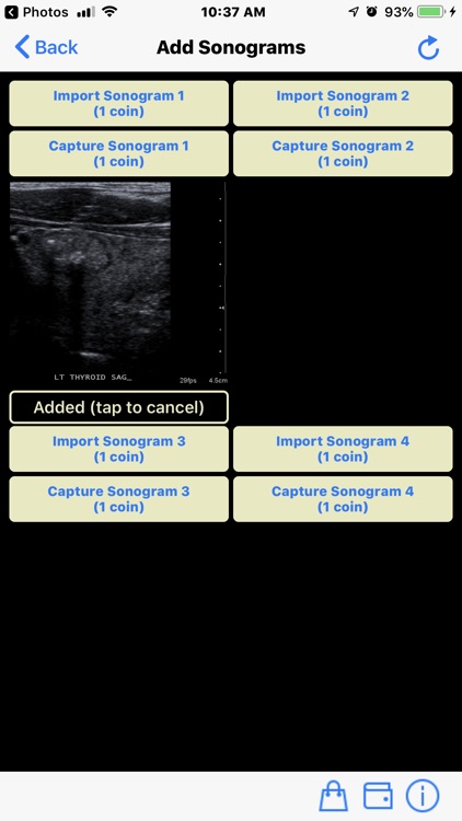 Ultrasound Reporting Tool screenshot-4