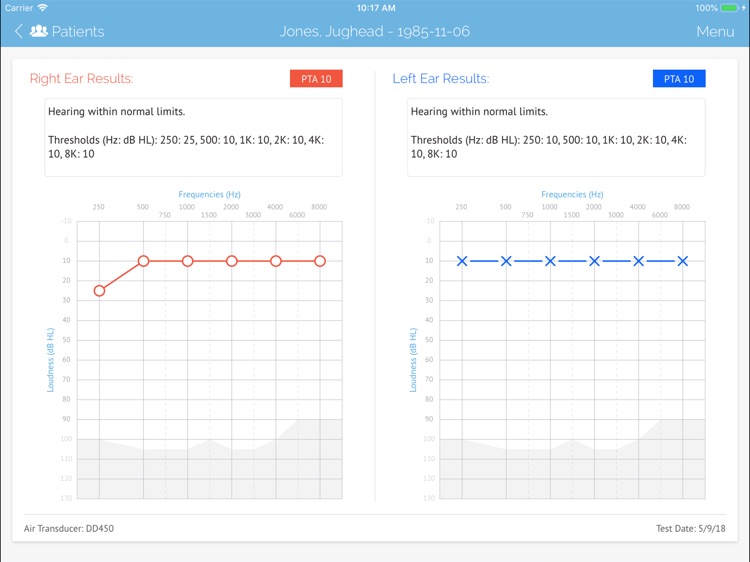 SHOEBOX Audiometry Pro screenshot-9