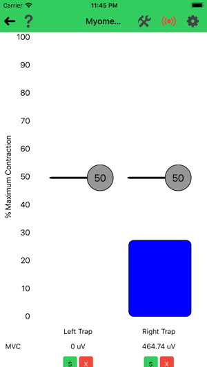 FlexVolt EMG(圖4)-速報App