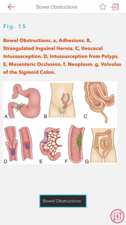 Medical Surgical RN Companion screenshot-4