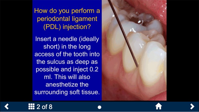 Dental Anesthesia-SecondLook(圖5)-速報App