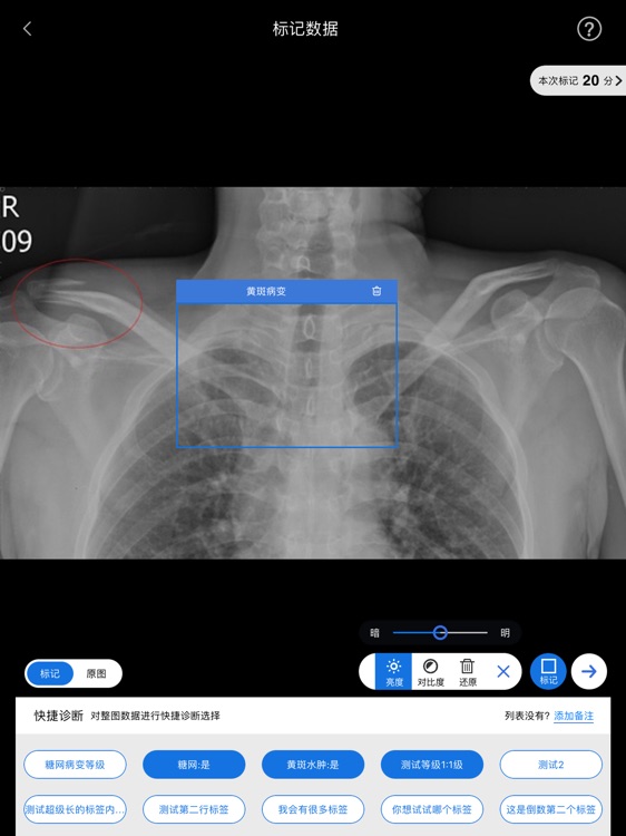 肽积木医疗影像移动标记平台 screenshot-3