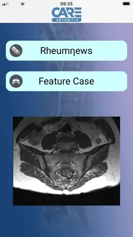 Game screenshot CARE Arthritis Mobile mod apk