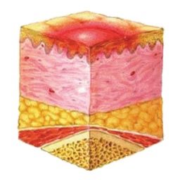 BCG Pressure Ulcer Guide