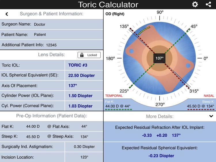 IOL Toric Calculator