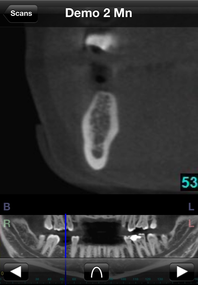 Dental CT View screenshot 3