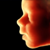 ScanBaby échographie bébé 