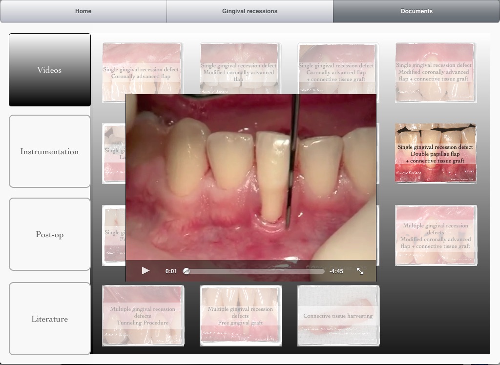 iMuco Récessions gingivales screenshot 4