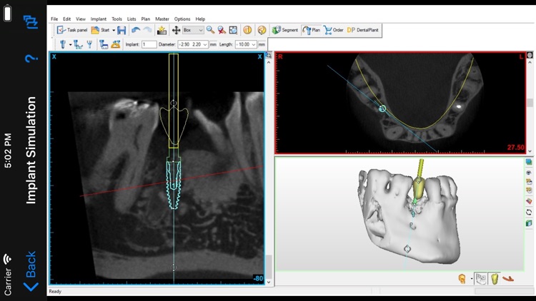 Dental CT View screenshot-3