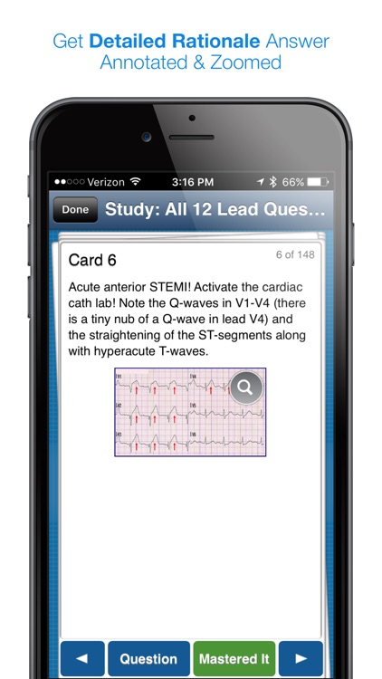 12 Lead ECG Challenge