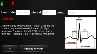 ECG Interpreter Screenshot 2