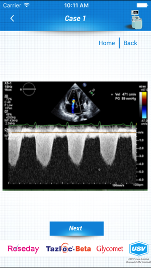 ECHO and ECG Interpretation(圖4)-速報App