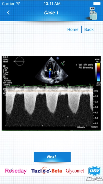 ECHO and ECG Interpretation screenshot-3