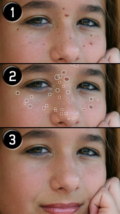 Pimple Eraser