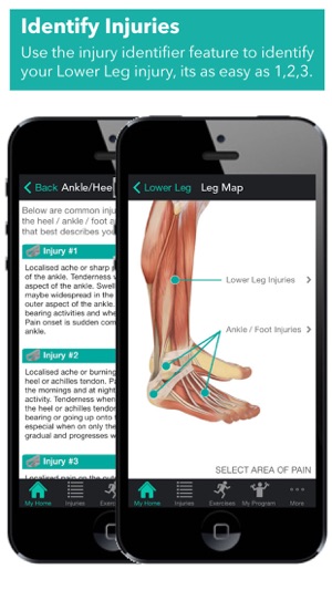 My Lower Leg Injury(圖2)-速報App