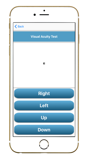 Advanced VISION Test(圖5)-速報App