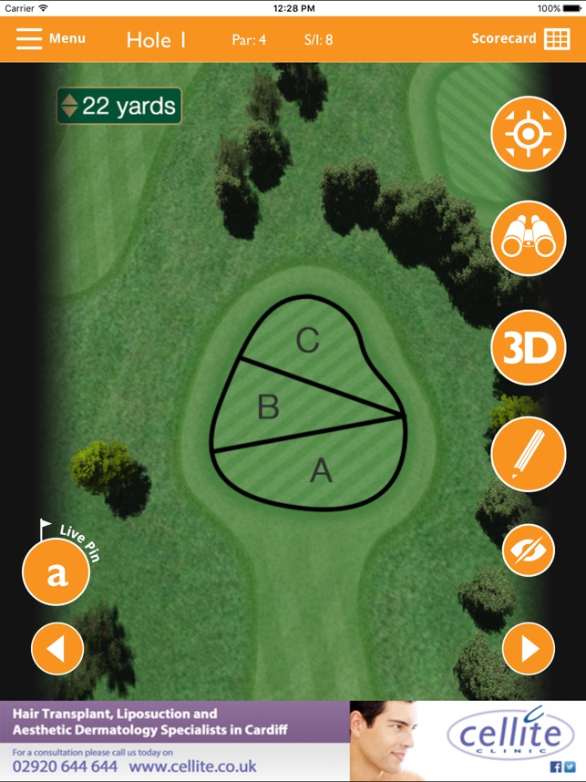 Peterstone Lakes Golf Club - Buggy(圖4)-速報App