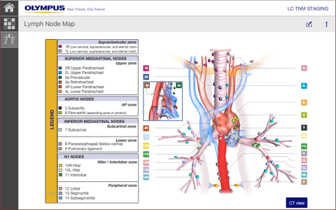 LC Staging screenshot 4