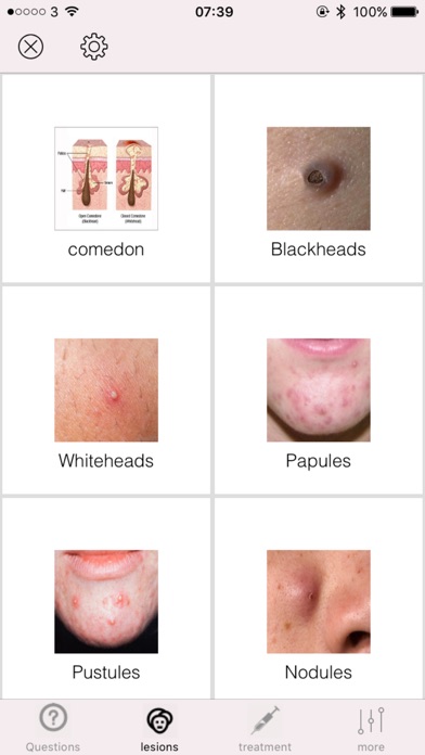 Acne immagine dello schermo #3