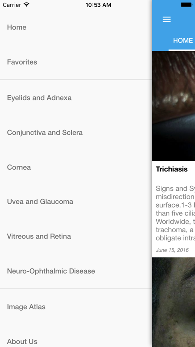 Ocular Disease Handbook screenshot 3